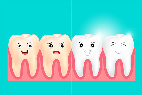 Why You Should Have a Bi-Annual Dental Cleaning from Assembly Dental in Somerville, MA