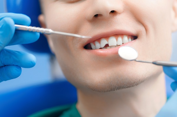 What to Do When You Have a Broken Tooth: Expert Dental Advice ...