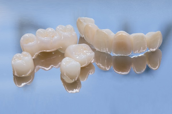 Improve Your Oral Health With A Dental Bridge