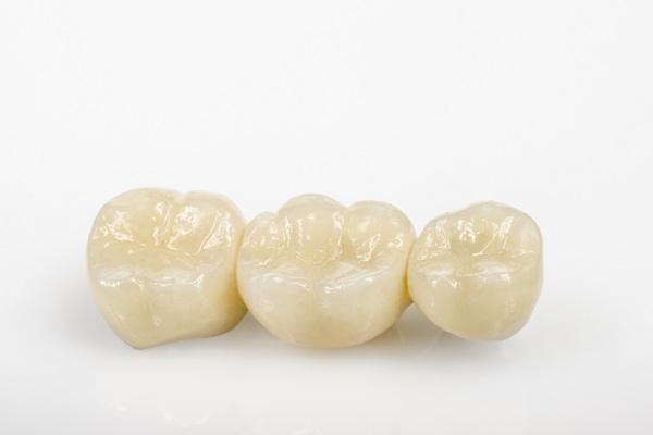 How To Tell If You Are A Candidate For A Dental Bridge