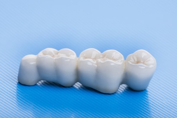 How Many Teeth Can A Dental Bridge Replace?