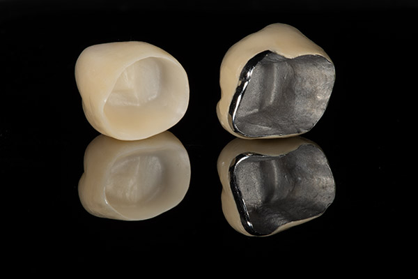 Will I Need a Dental Crown After a Root Canal Treatment? from Assembly Dental in Somerville, MA