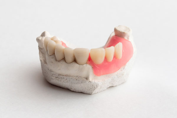 Denture Repairs When Dentures Warp