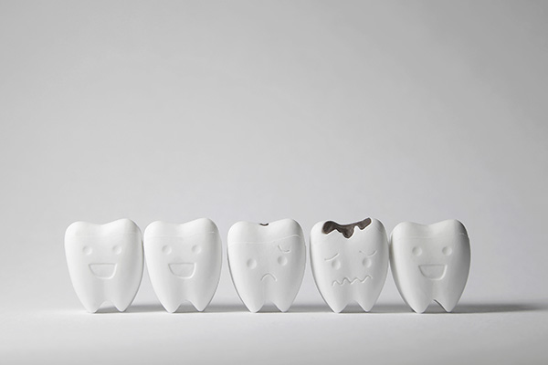 How a General Dentist Can Treat Tooth Decay from Assembly Dental in Somerville, MA