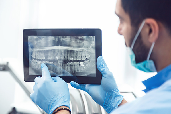 General Dentistry: Are Dental X-rays Recommended? from Assembly Dental in Somerville, MA