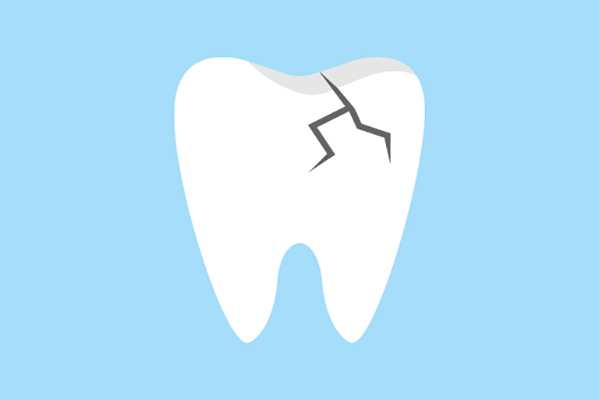 General Dentistry Treatments for a Damaged Tooth from Assembly Dental in Somerville, MA