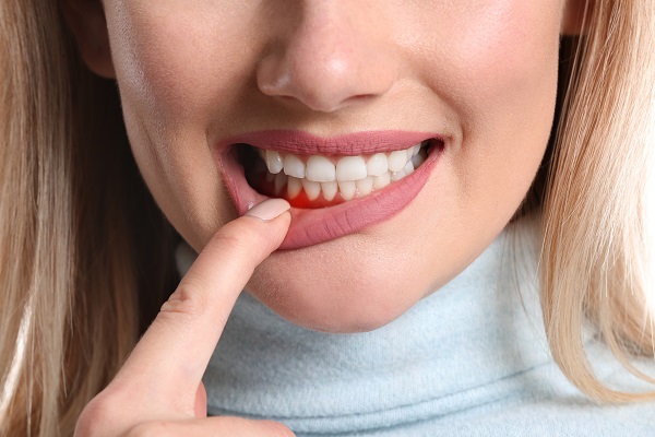 Can Gum Disease Be Cured?