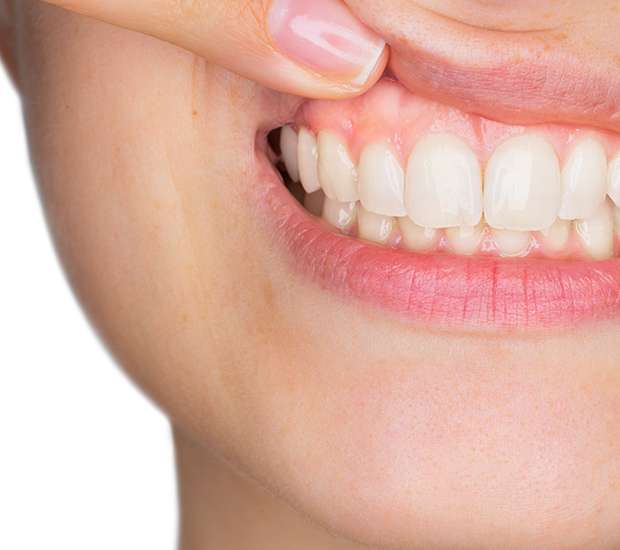 Somerville Gum Disease