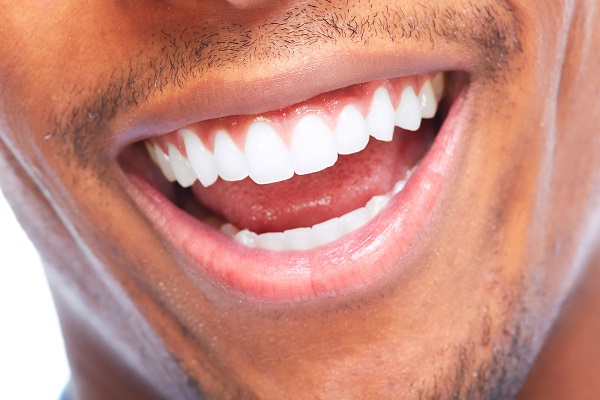 Smile Makeover Restoration Options For A Damaged Tooth