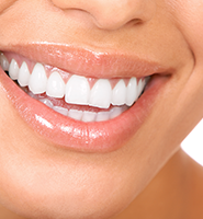 Teeth Whitening Services Somerville, MA