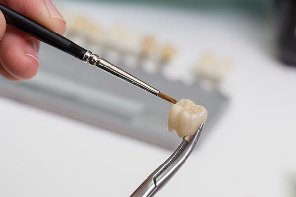 What You Should Know About The CEREC Crown Procedure